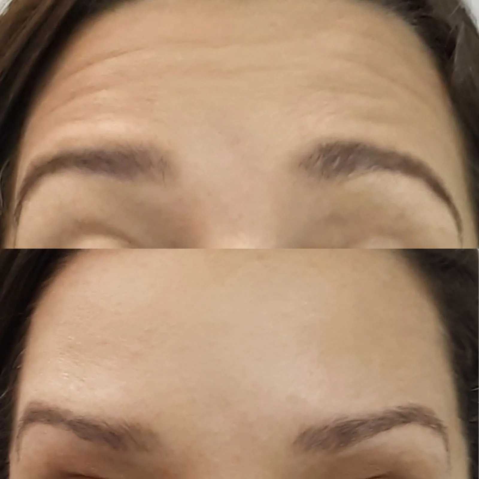 Antes e depois 1