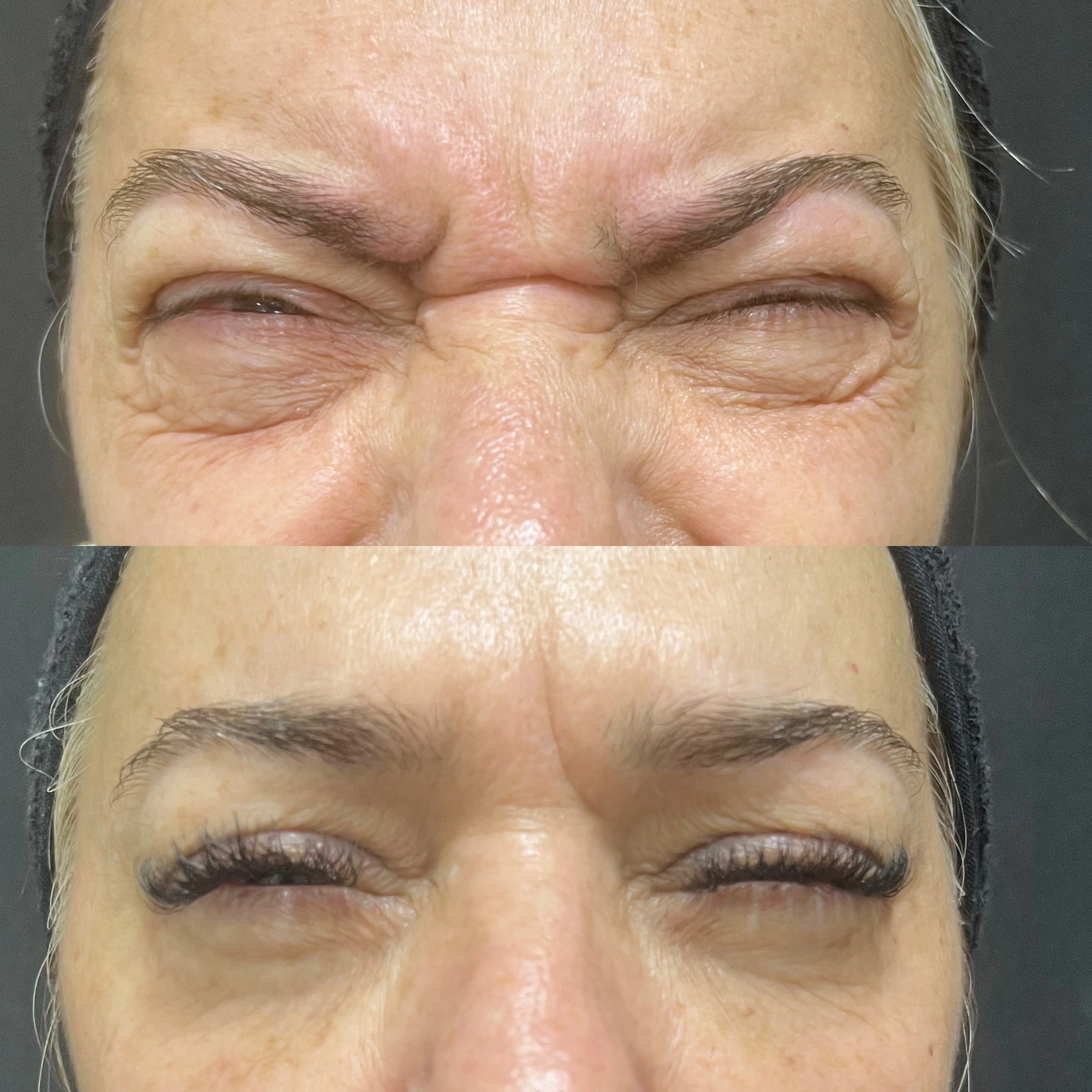 Antes e depois 2