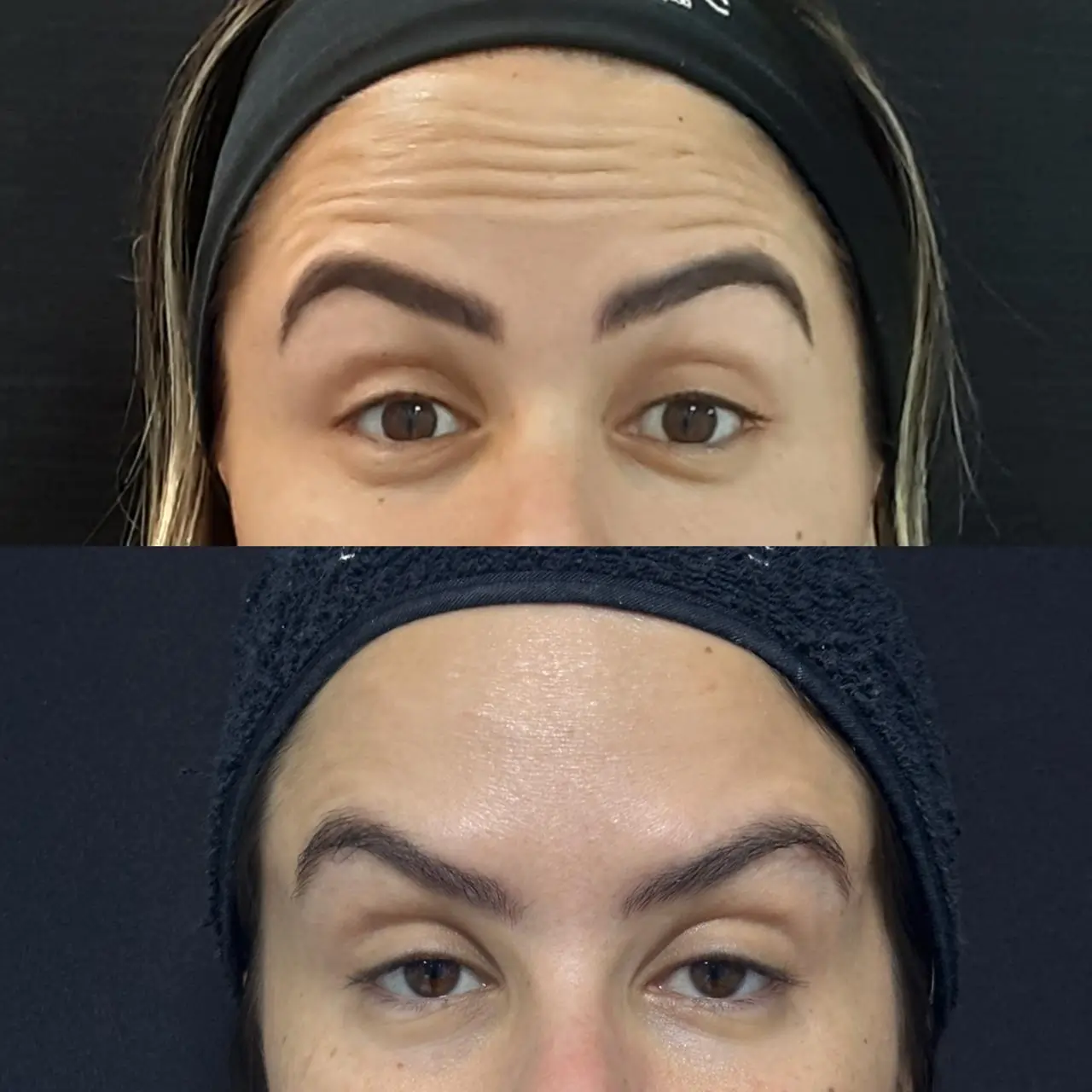 Antes e depois 3